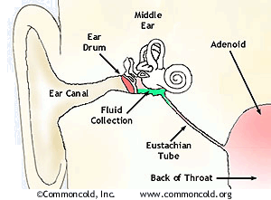 How common is eustachian tube dysfunction in adults